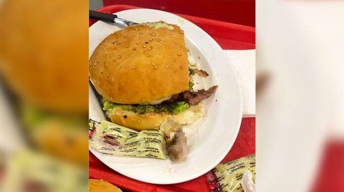 Encuentran dedo humano dentro de hamburguesa; policía confirma que es real