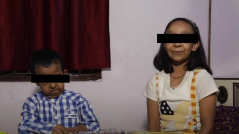 ¡Increíble! Hermanos de 5 y 11 años parecen viejitos por un trastorno genético