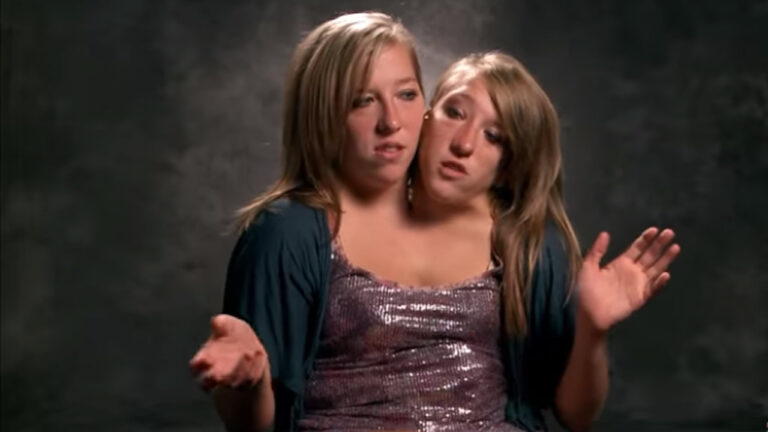 Famosas siamesas de Discovery Channel visitan Mahahual