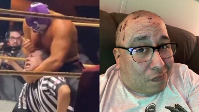 Referí aceptó dinero para dejarse apuñalar en la cabeza por luchador