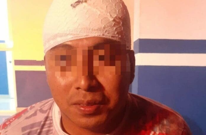 Un sujeto en estado de ebriedad fue detenido luego de que se pusiera a golpear a su parerja delante de sus hijas en Playa del Carmen. Foto: SP de Solidaridad