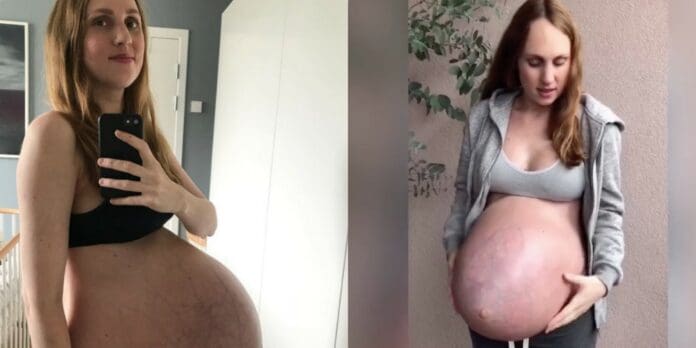 Influencer embarazada de trillizos muestra fotos impactantes de los cambios en su panza