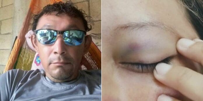 Por intento de feminicidio y secuestro, mujer denuncia a su expareja ante la FGE