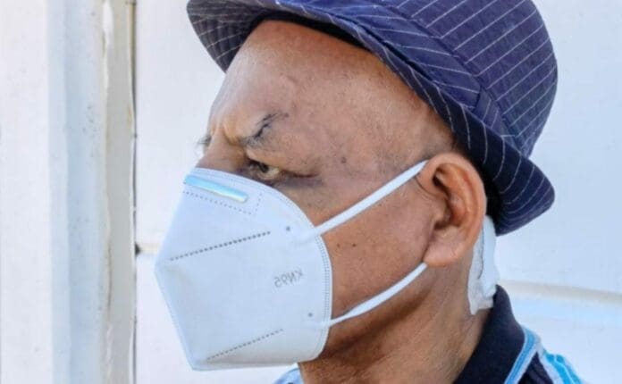 Un periodista sufrió un intento de ejecución en Yucatán; por suerte la libró aunque sí resultó herido; ya denunció los hechos. Foto: Redes sociales