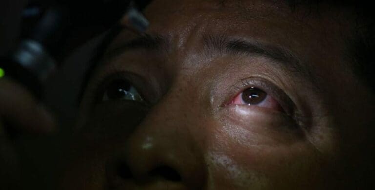 Una investigadora señala que la conjuntivitis podría manifestarse como un síntoma de contagio de la variante Ómicron. ¿Qué tal? Foto: RT