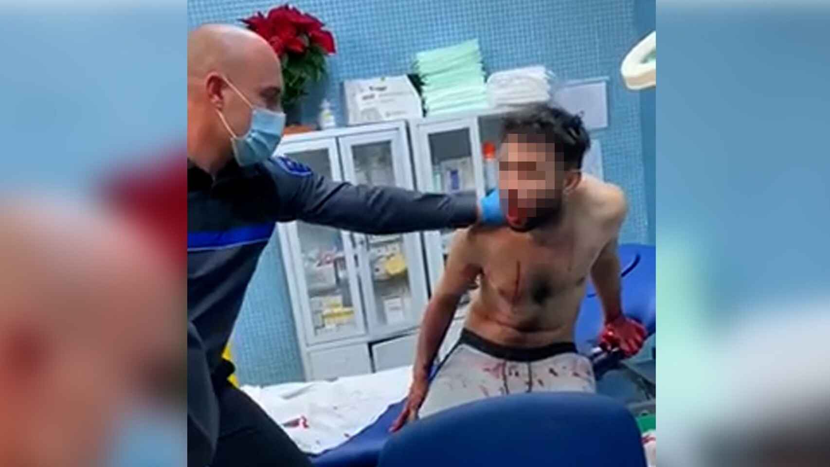 VIDEO SENSIBLE: Hombre se devora a sí mismo tras consumir droga caníbal