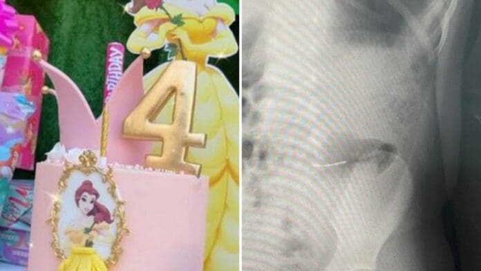 Fiesta de niña termina en problemas, hospitalizan a la hermana y a la cumpleañera por ingerir metal que tenía el pastel