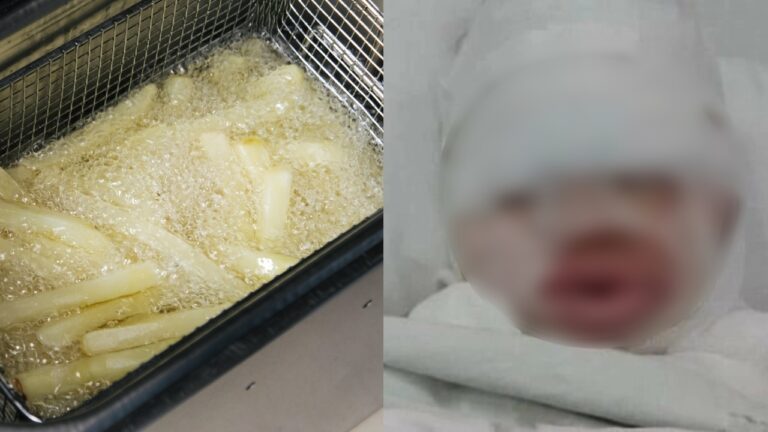 Empleada quema a bebé con aceite hirviendo