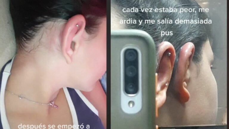 Video: Joven pierde parte de su oreja tras hacerse piercing