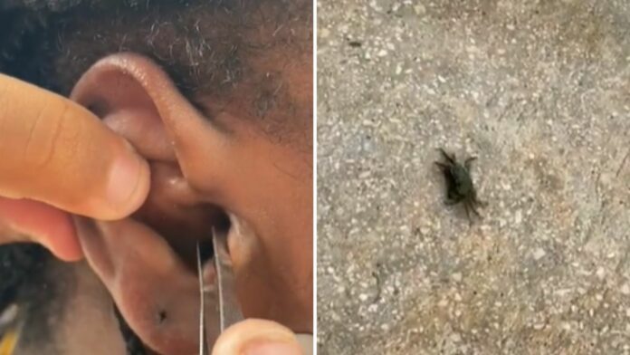 VIDEO: Cangrejo entra en el oído de turista mientras buceaba y llora de dolor mientras lo sacan