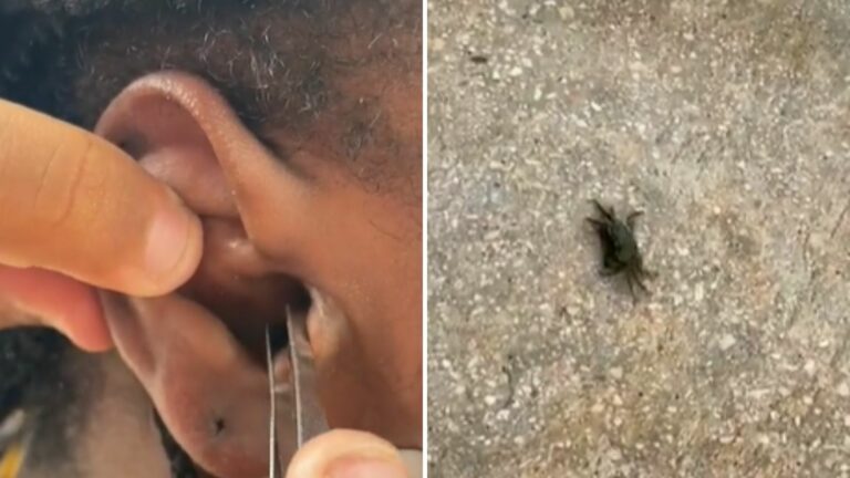 VIDEO: Cangrejo entra en el oído de turista mientras buceaba y llora de dolor mientras lo sacan