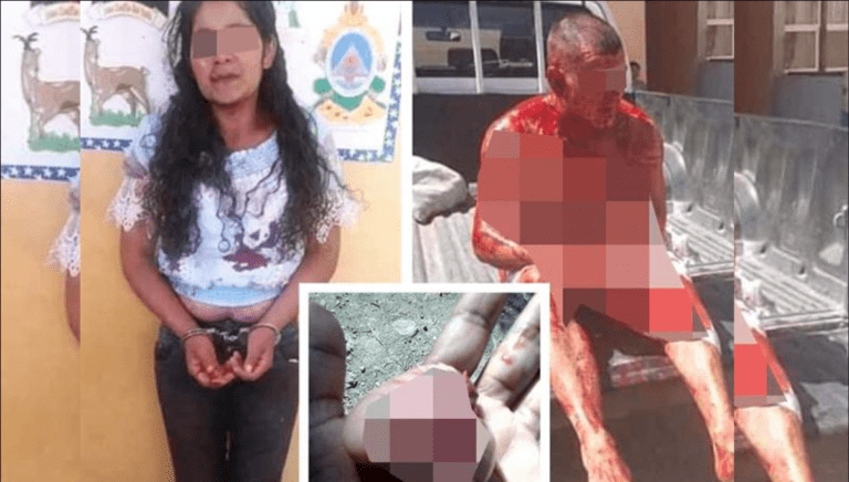 Mujer le corta los testiculos a su pareja tras encontrarlo en la cama con su vecina