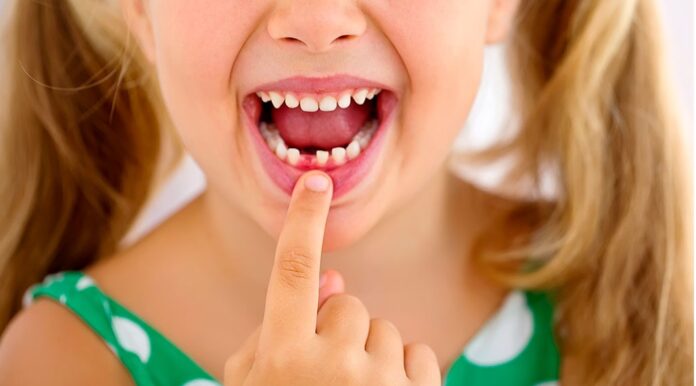 Niña pierde su diente y se hace viral tras escribir una carta al ratón de los dientes