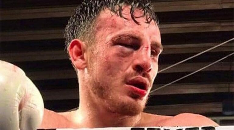 Omar Chávez, el hijo de la leyenda, sufrió una dolorosa derrota este fin de semana. Hay quienes de plano le sugieren que se retire.