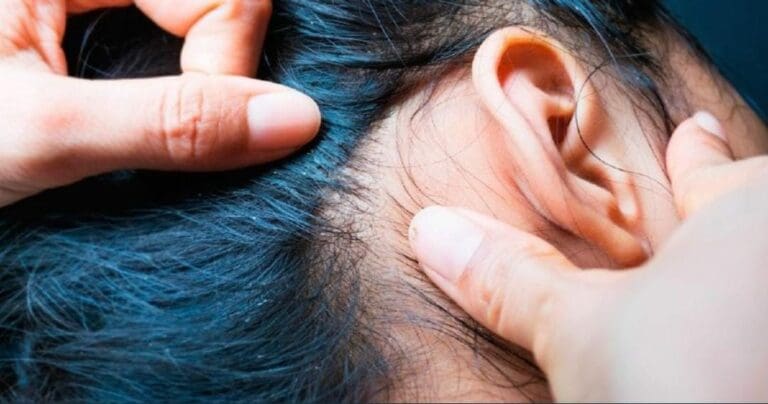 Una niña murió luego que se le complicara una infección de piojos; culpan a la familia pues además estaba desnutrida y anémica.