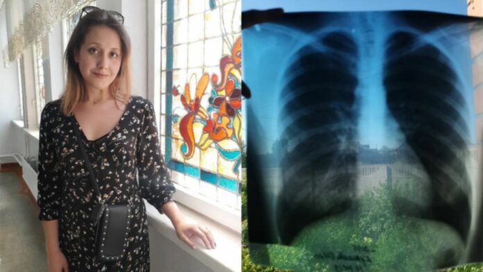 Mujer va al hospital por una neumonía, descubren que tiene tres órganos del lado contrario