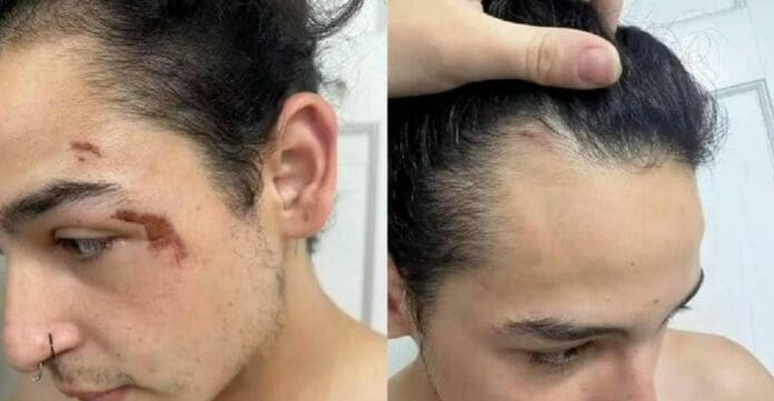 Un hombre trans denunció que fue víctima de agresiones y además fue injustamente arrestado luego de ser golpeado.