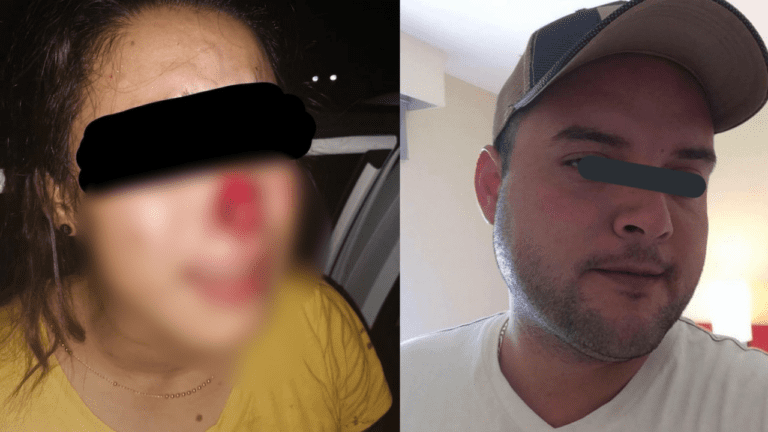 Excandidato a alcalde le arranca la nariz a mordidas a joven por no ser correspondido