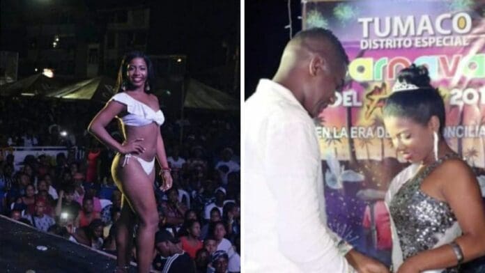 Ex reina de belleza es golpeada, rociada con gasolina y quemada por su pareja