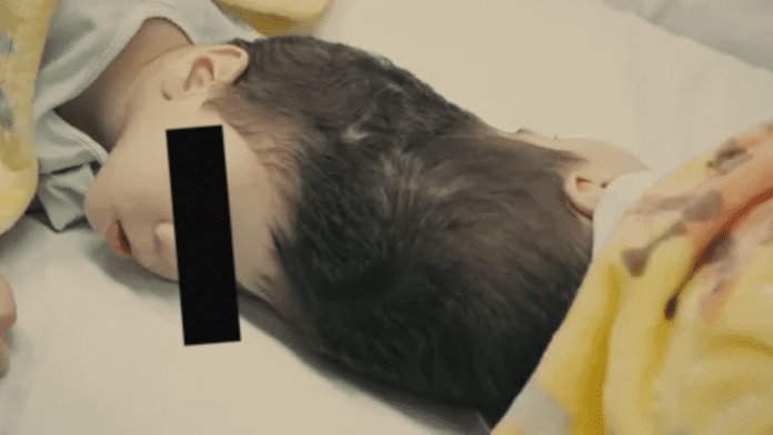 Logran con éxito separación de siameses unidos por la cabeza en Brasil