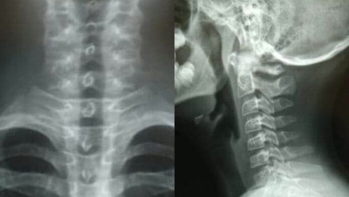 Maestro estrangula a alumno por salpicarlo con agua