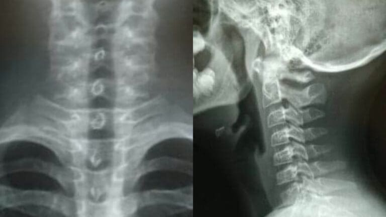 Maestro estrangula a alumno por salpicarlo con agua