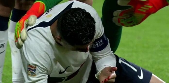 Cristiano Ronaldo recibe fuerte golpe en el rostro en el Portugal vs República Checa
