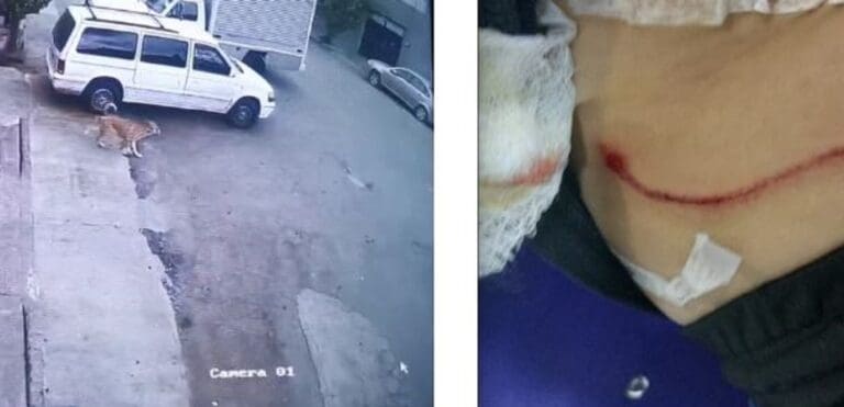 Perro ataca a menor; dueño agrede a familiares afectados