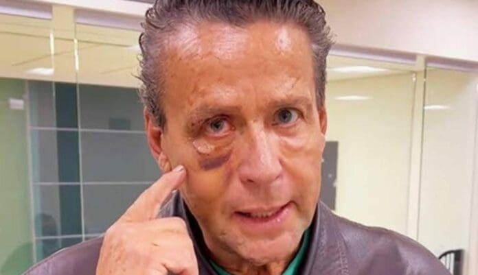 Alfredo Adame informó a través de sus redes sociales que este día sería sometido a una operación de emergencia, debido a sus lesiones.