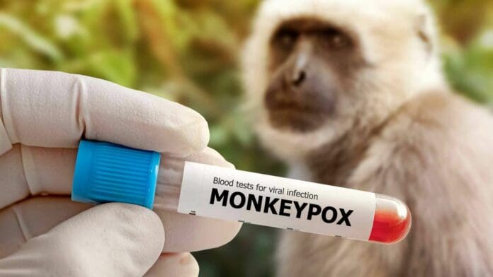 Reportan las primeras 4 muertes por viruela símica en México