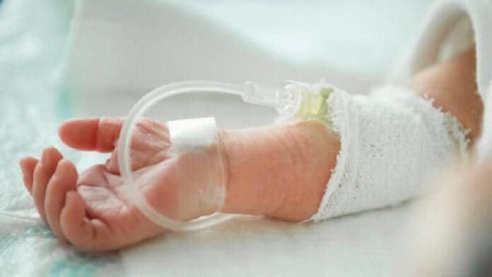 Bebé cae en olla de asado durante bautizo en Torreón; sufre quemaduras en la mitad de su cuerpo