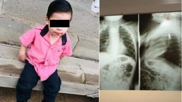 Bebé en estado de gravedad en Sonora tras tragar pila que le explotó en el estómago