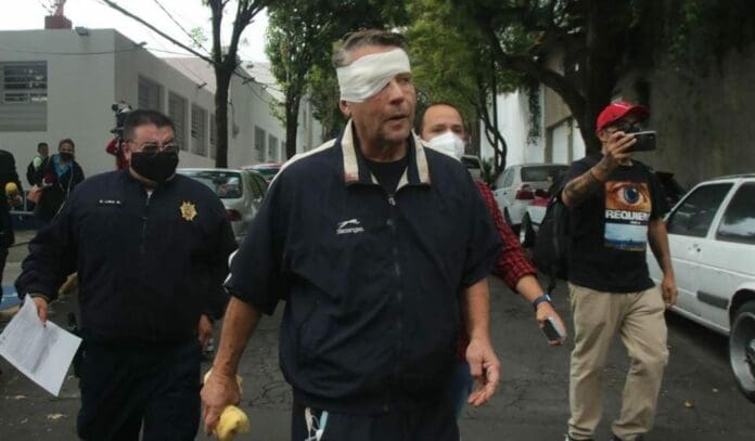 El actor Alfredo Adame reveló que a consecuencia de la golpiza recibida, ha perdido hasta el 30 por ciento de su visión.