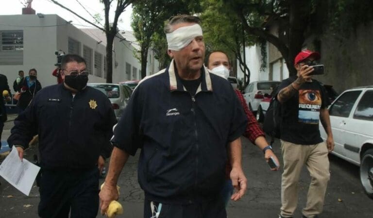 El actor Alfredo Adame reveló que a consecuencia de la golpiza recibida, ha perdido hasta el 30 por ciento de su visión.