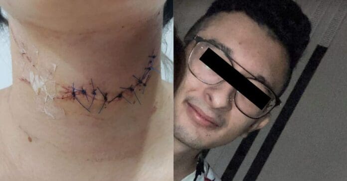 Mariana, de 20 años, denuncia intento de feminicidio de su “mejor amigo” en Veracruz