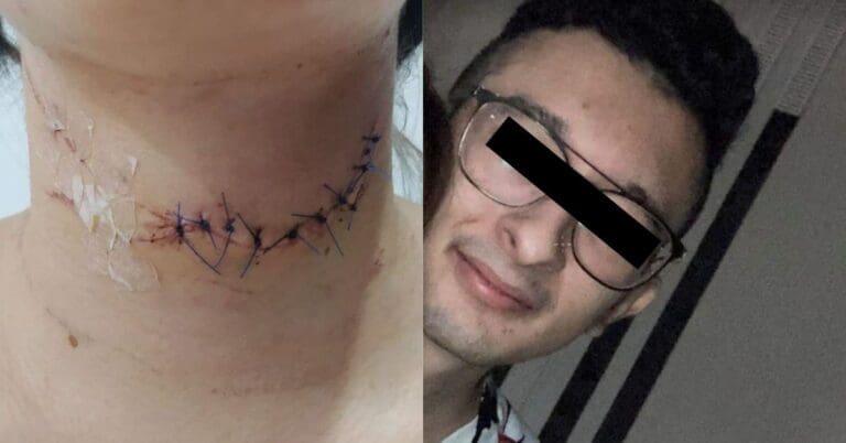 Mariana, de 20 años, denuncia intento de feminicidio de su “mejor amigo” en Veracruz