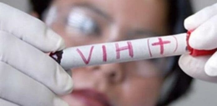 Tras trasplante de células madre, tercer paciente de VIH logra curarse por completo de la enfermedad