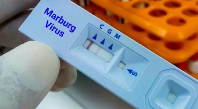 OMS se reunió de emergencia por muertes del virus de Marburgo