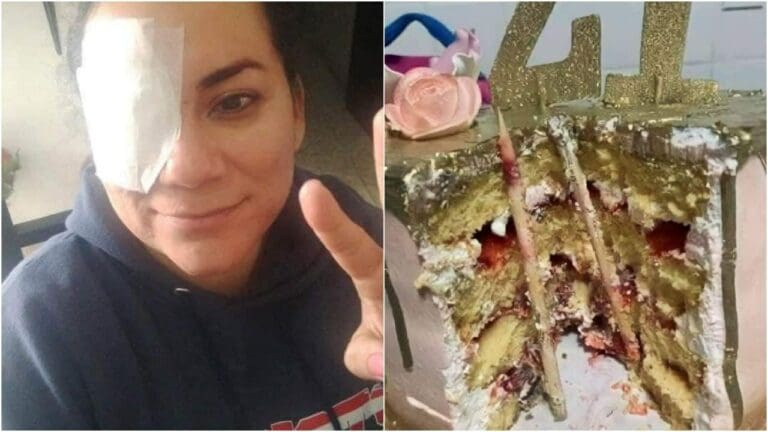 Mujer recibe pastelazo y casi pierde el ojo