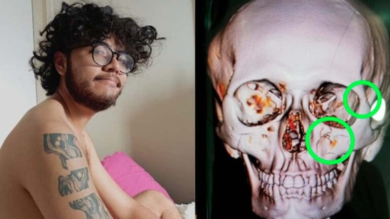 Pareja denuncia robo y agresión en bar LGBT+ de la CDMX: “Me fracturaron la cara”