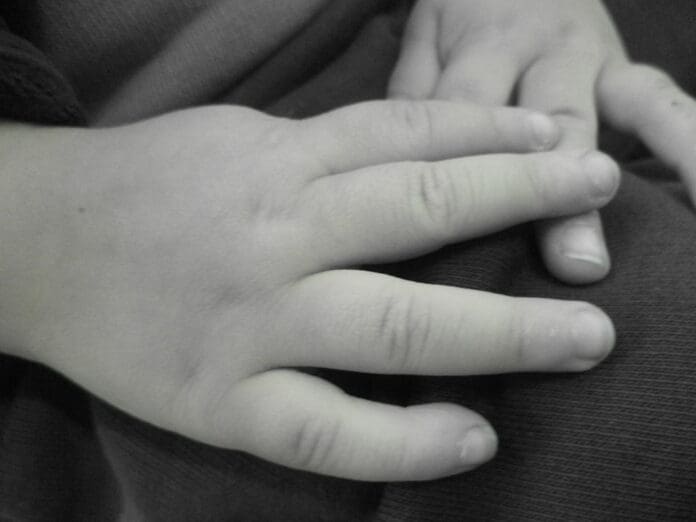 Acusan a sujeto de maltrato infantil en Puebla tras quemar las manos de su hija en un comal