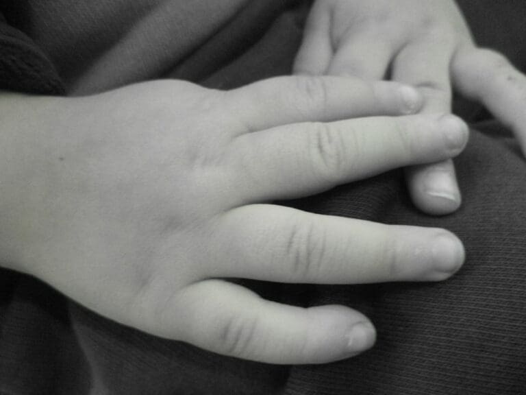 Acusan a sujeto de maltrato infantil en Puebla tras quemar las manos de su hija en un comal