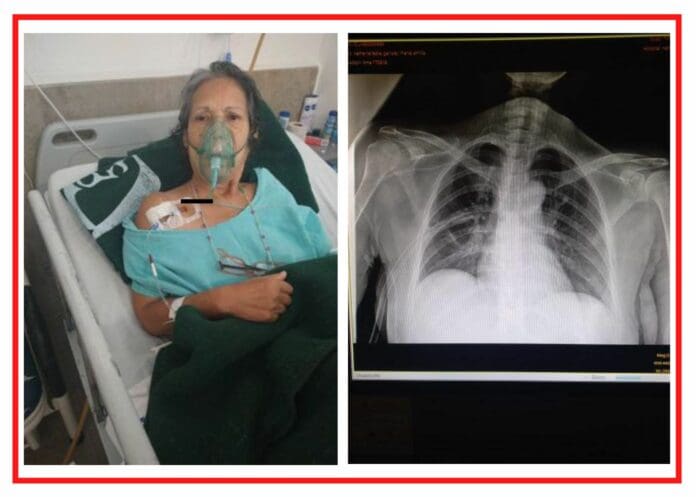 Denuncian NEGLIGENCIA en el IMSS: Fue a que le quitaran la vesícula y le perforaron el pulmón