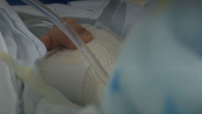 Niño pierde su brazo al meter la mano a un molino de carne en Tlajomulco