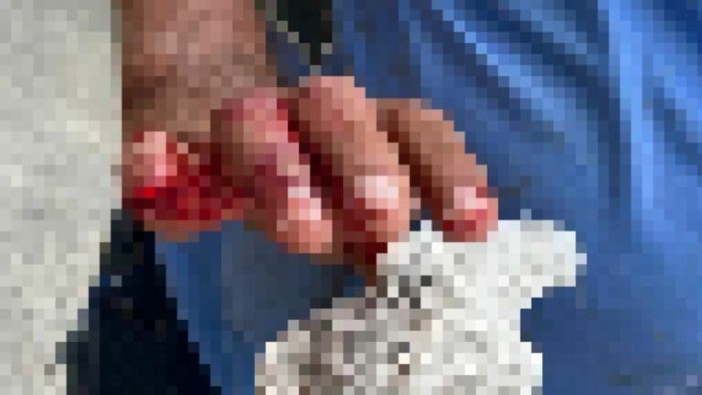 Turista arranca parte del dedo a empleado municipal afuera de un Oxxo en Playa del Carmen