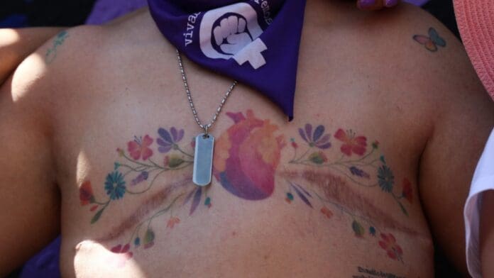 Gobierno canceló Normas Oficiales sobre cáncer de mama, cérvico uterino y lactancia materna