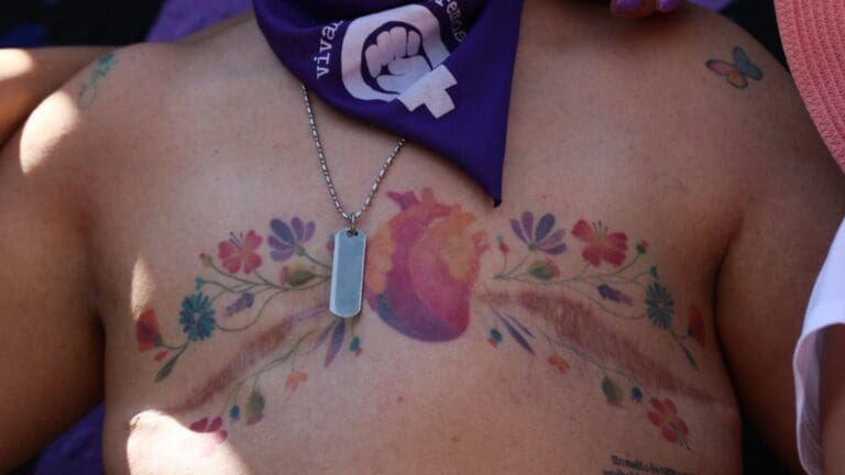 Gobierno canceló Normas Oficiales sobre cáncer de mama, cérvico uterino y lactancia materna