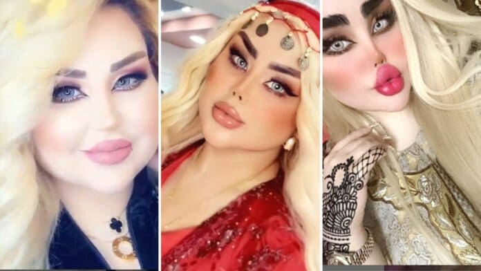 Mujer se sometió a 40 operaciones para ser la Barbie Iraquí