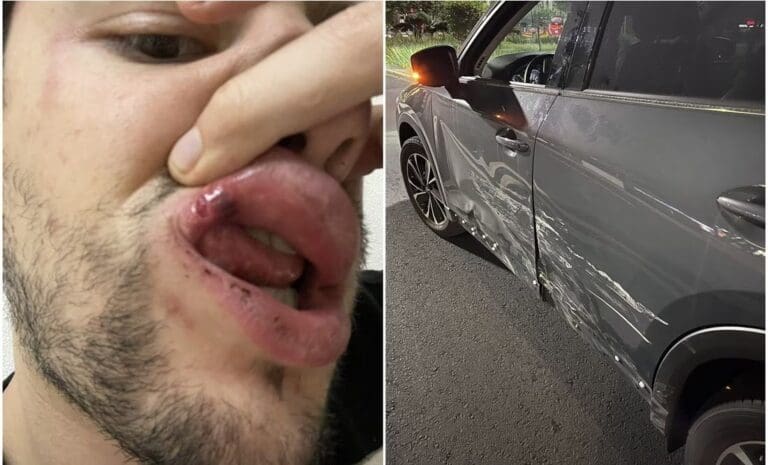 VIDEO El comentarista deportivo Alex Déleon denuncia a policías de CDMX por presunta agresión tras choque en Avenida Universidad