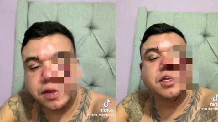 VIDEO: Mesero acusa a encargados de La Vaca Argentina en Cancún de golpearlo a él y su pareja